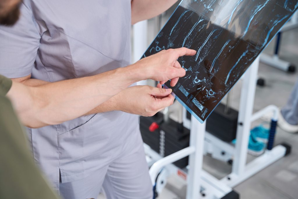Doctor with patient examining x-rays of injuries in modern rehabilitation center
