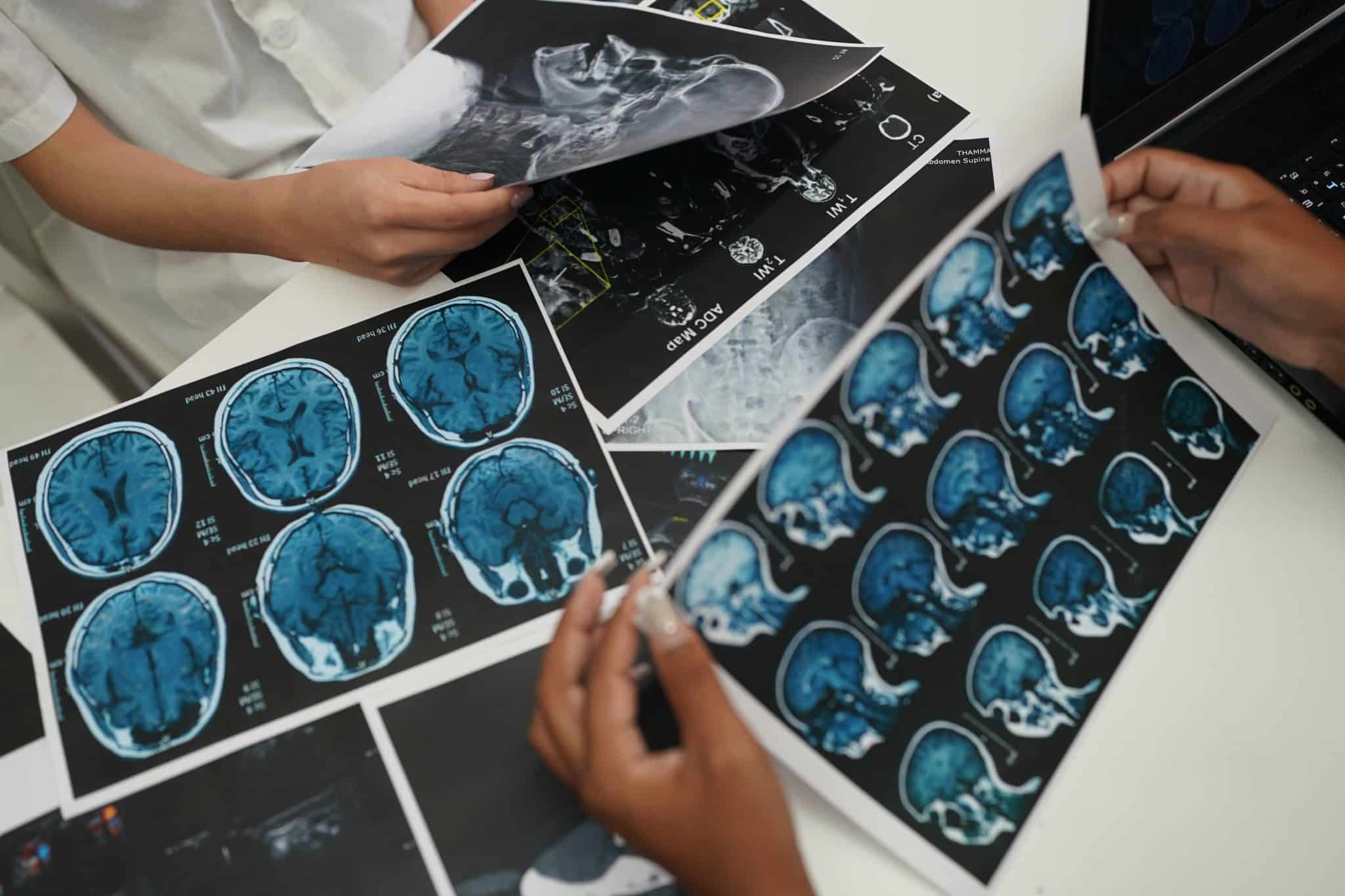 Group of doctors looking at X-ray on medical conference, discussing issues